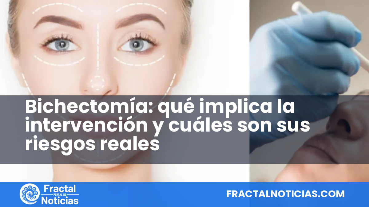 Bichectomía: qué implica la intervención y cuáles son sus riesgos reales — Fractal Noticias