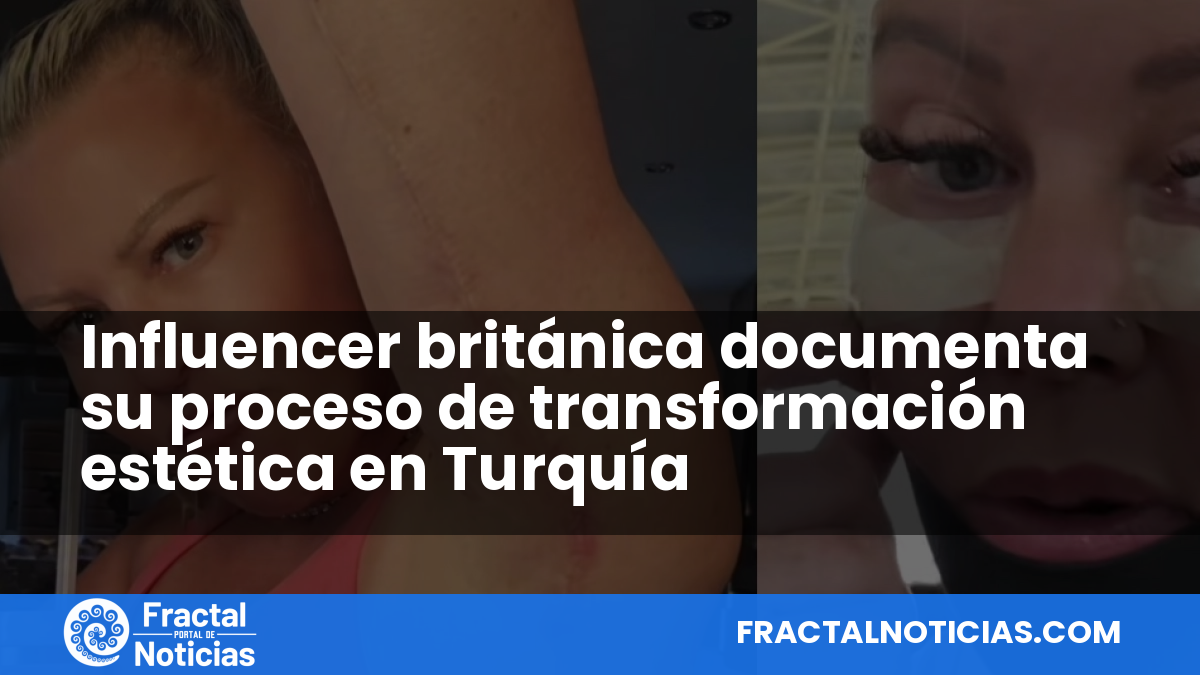 Influencer británica documenta su proceso de transformación estética en Turquía — Fractal Noticias