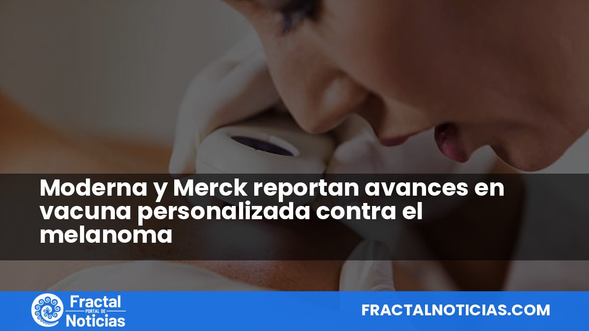 Moderna y Merck reportan avances en vacuna personalizada contra el melanoma — Fractal Noticias